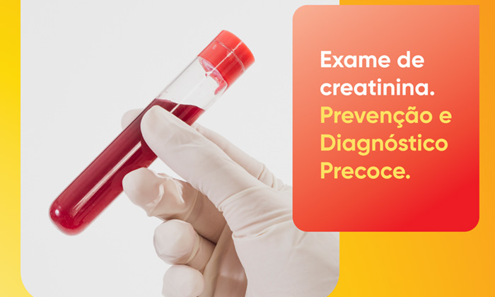 Exame de Creatinina: diagnóstico precoce da doença renal